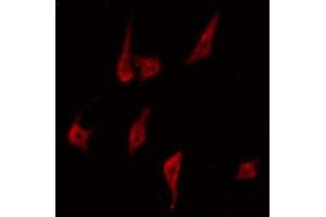ABIN6267618 staining NIH-3T3 by IF/ICC. (PKC delta 抗体  (pTyr313))