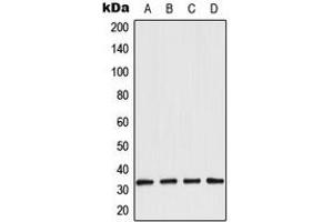 Western blot analysis of Aquaporin 3 expression in LOVO (A), A431 (B), NIH3T3 (C), rat kidney (D) whole cell lysates. (AQP3 抗体  (Center))