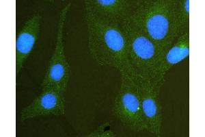 IF analysis of SCRIBBLE using anti-SCRIBBLE antibody (ABIN5693286).