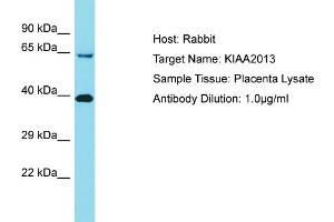 Host: Rabbit Target Name: KIAA2013 Sample Tissue: Human Placenta Antibody Dilution: 1ug/ml (KIAA2013 抗体  (C-Term))