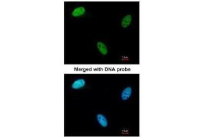 Immunofluorescence (IF) image for anti-Deoxycytidine Kinase (DCK) (Center) antibody (ABIN2856517)