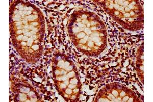 IHC image of ABIN7160120 diluted at 1:1200 and staining in paraffin-embedded human appendix tissue performed on a Leica BondTM system.