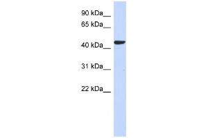 Western Blotting (WB) image for anti-Sphingomyelin Synthase 2 (SGMS2) antibody (ABIN2459623) (Sphingomyelin Synthase 2 抗体)