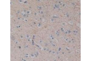 Detection of SP in Human Brain Tissue using Polyclonal Antibody to Substance P (SP) (Substance P 抗体)