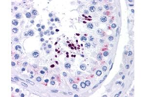 Immunohistochemistry (IHC) image for anti-Cyclin D1 (CCND1) (N-Term) antibody (ABIN2777893) (Cyclin D1 抗体  (N-Term))