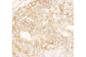 Immunohistochemistry (IHC) image for anti-Ribosomal Protein L7 (RPL7) (C-Term) antibody (ABIN7449014)