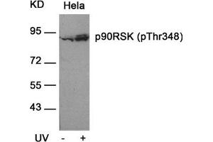 Western blot analysis of extracts from Hela cells untreated or treated with UV using p90RSK(Phospho-Thr348) Antibody. (RPS6KA1 抗体  (pThr348))
