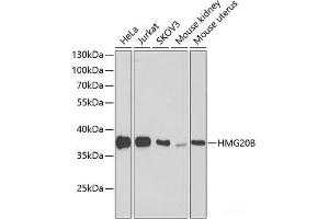 Western blot analysis of extracts of various cell lines using HMG20B Polyclonal Antibody at dilution of 1:1000. (HMG20B 抗体)