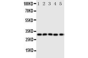 Anti-Aquaporin 9 antibody, Western blottingAll lanes: Anti Aquaporin 9  at 0. (AQP9 抗体  (C-Term))