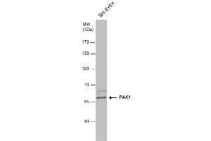 WB Image PAK1 antibody detects PAK1 protein by western blot analysis. (PAK1 抗体  (Center))