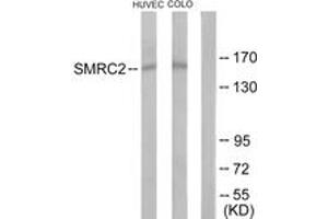 Western blot analysis of extracts from HuvEc/COLO205 cells, using SMRC2 Antibody. (SMARCC2 抗体  (AA 361-410))