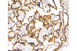IHC analysis of TANK using anti-TANK antibody (ABIN6719508). (TANK 抗体)
