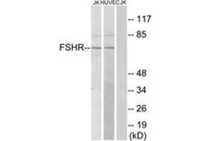 Western blot analysis of extracts from Jurkat/HuvEc cells, using FSHR Antibody. (FSHR 抗体  (AA 211-260))