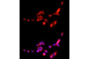 Immunofluorescence analysis of SH-SY5Y cells using SLC17 Rabbit pAb (ABIN6127303, ABIN6147863, ABIN6147864 and ABIN6216671) at dilution of 1:250 (40x lens). (SLC17A7 抗体  (AA 461-560))