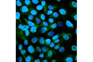 IF analysis of Gpnmb using anti-Gpnmb antibody (ABIN7600217). (Osteoactivin 抗体  (AA 164-564))