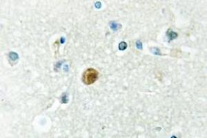 Image no. 1 for anti-Interferon Regulatory Factor 3 (IRF3) antibody (ABIN317879) (IRF3 抗体)