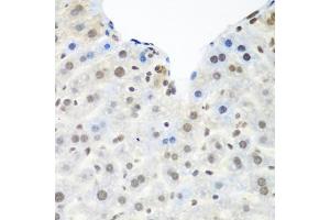 Immunohistochemistry of paraffin-embedded mouse liver using TARDBP antibody. (TARDBP 抗体)