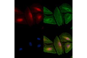 ABIN6257054 and ABIN6274619 staining  cells by IF/ICC.
