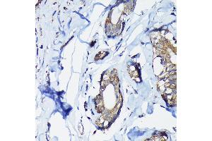 Immunohistochemistry (IHC) image for anti-Paternally Expressed 10 (PEG10) (AA 1-325) antibody (ABIN1681320)