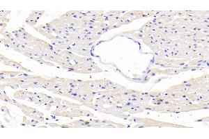 Detection of SLC in Rat Cardiac Muscle Tissue using Polyclonal Antibody to Secondary Lymphoid Tissue Chemokine (SLC) (CCL21 抗体  (AA 5-132))
