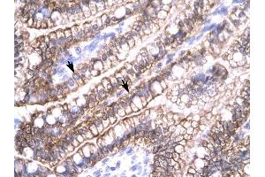 Claudin 8 antibody was used for immunohistochemistry at a concentration of 4-8 ug/ml to stain Epithelial cells of intestinal villus (arrows) in Human Intestine. (CLDN8 抗体  (C-Term))