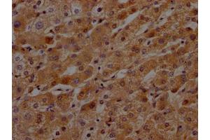 IHC image of ABIN7127592 diluted at 1:100 and staining in paraffin-embedded human liver tissue performed on a Leica BondTM system. (Recombinant KLKB1 抗体)