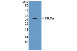 Figure. (Phospholipase C gamma 2 抗体  (AA 930-1152))
