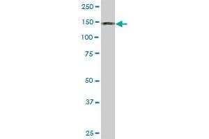 DDEF1 monoclonal antibody (M01), clone 2G7. (ASAP1 抗体  (AA 1030-1129))