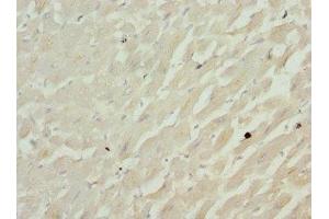 Immunohistochemistry of paraffin-embedded human heart tissue using ABIN7148048 at dilution of 1:100 (Cofilin 2 抗体  (AA 1-166))