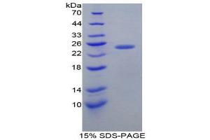 SDS-PAGE (SDS) image for Fibroblast Growth Factor Receptor Substrate 2 (FRS2) (AA 268-453) protein (His tag) (ABIN1879464)