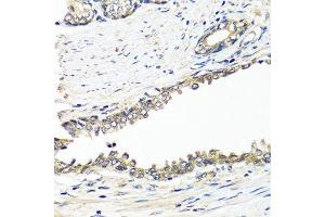 Immunohistochemistry of paraffin-embedded human prostate using BRCA1 antibody. (BRCA1 抗体  (AA 120-220))
