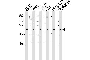 Western blot analysis of lysates from 293T, Hela, Jurkat, Y79 cell line , mouse spleen and rat kidney tissue lysate(from left to right), using DHFR Antibody (N-term) (ABIN6242878 and ABIN6577408). (Dihydrofolate Reductase 抗体  (N-Term))