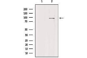 Western blot analysis of extracts from HepG2, using PLA2G4F Antibody. (PLA2G4F 抗体  (C-Term))