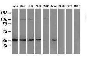 Image no. 2 for anti-Nonhomologous End-Joining Factor 1 (NHEJ1) antibody (ABIN1499732) (NHEJ1 抗体)