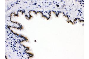 Anti-ARSA Picoband antibody,IHC(P) IHC(P): Rat Lung Tissue (Arylsulfatase A 抗体  (C-Term))