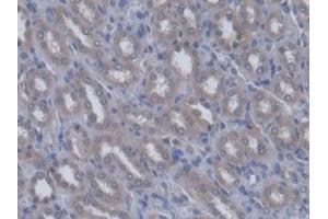 DAB staining on IHC-P; Samples: Rat Kidney Tissue (QARS 抗体  (AA 2-206))