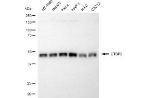 Western blotting analysis using CTBP2 antibody (ABIN7797817).
