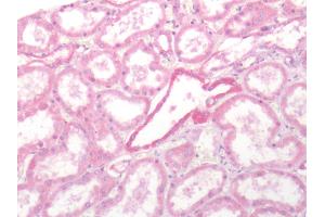 Human Kidney: Formalin-Fixed, Paraffin-Embedded (FFPE) (SSTR2 抗体  (Extracellular Domain))