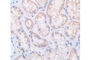 Figure. (Multimerin 1 抗体  (AA 807-1053))