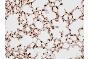 IHC-P Image Immunohistochemical analysis of paraffin-embedded human lung, using BAF57, antibody at 1:100 dilution.