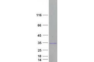 Validation with Western Blot