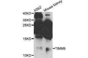 Western blot analysis of extracts of K562 and mouse kidney cells, using TIMM9 antibody. (TIMM9 抗体)