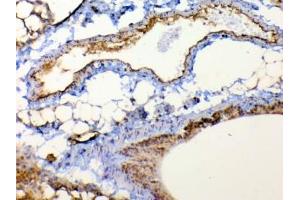 IHC testing of FFPE mouse lung tissue with TSPAN12 antibody at 1ug/ml.