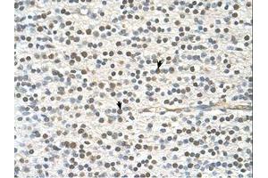 Image no. 1 for anti-GTPase Activating Protein and VPS9 Domains 1 (GAPVD1) (AA 182-231) antibody (ABIN6739157) (GAPVD1 抗体  (AA 182-231))