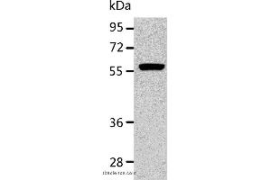 Western blot analysis of K562 cell, using ALDH1A2 Polyclonal Antibody at dilution of 1:400 (ALDH1A2 抗体)