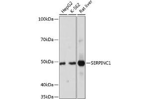 Western blot analysis of extracts of various cell lines, using SERPINC1 Rabbit mAb (ABIN7270208) at 1:1000 dilution. (SERPINC1 抗体)