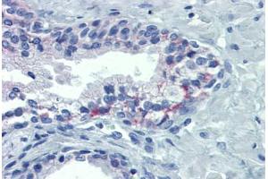 Human Prostate: Formalin-Fixed, Paraffin-Embedded (FFPE) (OR51E1 抗体  (AA 79-141))