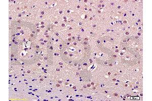 Formalin-fixed and paraffin embedded rat brain labeled with Anti-Thrap3/TRAP150 Polyclonal Antibody, Unconjugated (ABIN1387545) at 1:200 followed by conjugation to the secondary antibody and DAB staining (THRAP3 抗体  (AA 631-730))