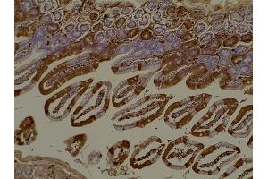 Immunohistochemistry (IHC) image for anti-Red Fluorescent Protein (RFP) antibody (ABIN129578)