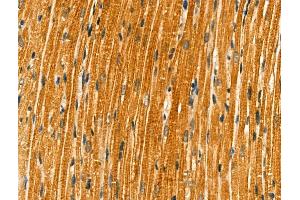 ABIN6261761 and ABIN6266840 at 1/100 staining Rat heart tissue by IHC-P. (FKRP 抗体  (N-Term))